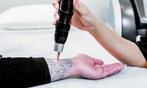 Up to 69% Off on Tattoo Removal at Fine Aesthetics