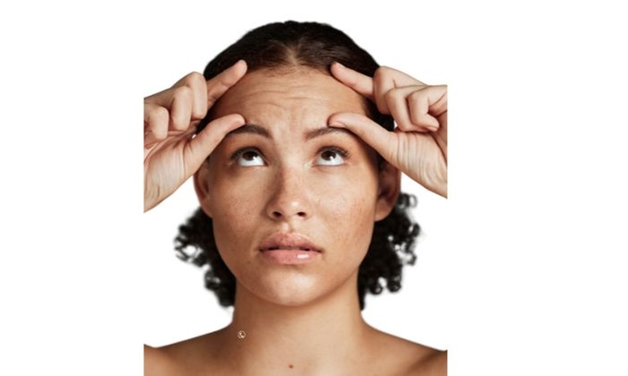 Smooth Out Wrinkles with 50 or 100 Units of Dysport