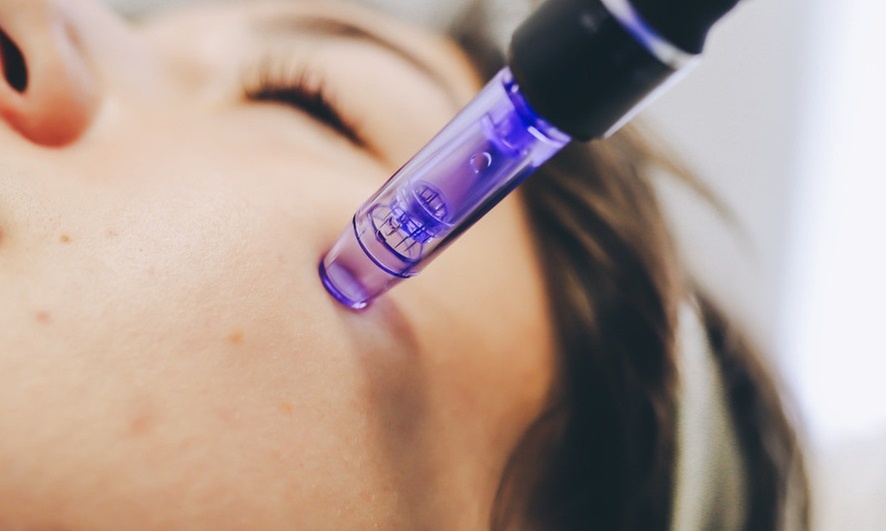 Up to 70% Off on Micro-Needling at Revive Medical Spa