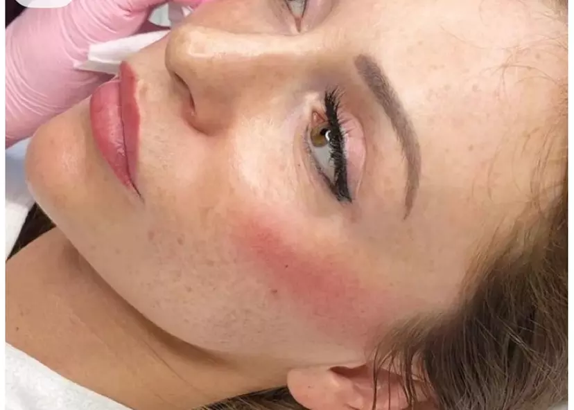 Areola Tattoo Treatment, Scalp Micropigmentation Or Cheek Blush Tattoo