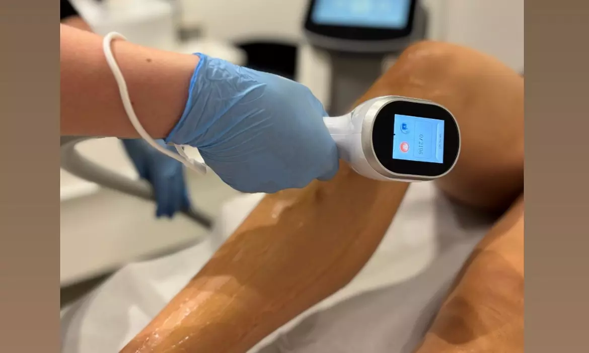 Depilacja laserowa wybranych obszarów