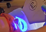 Crown Whitening & Optional Cleaning at Green Dental (Up to 52% Off)