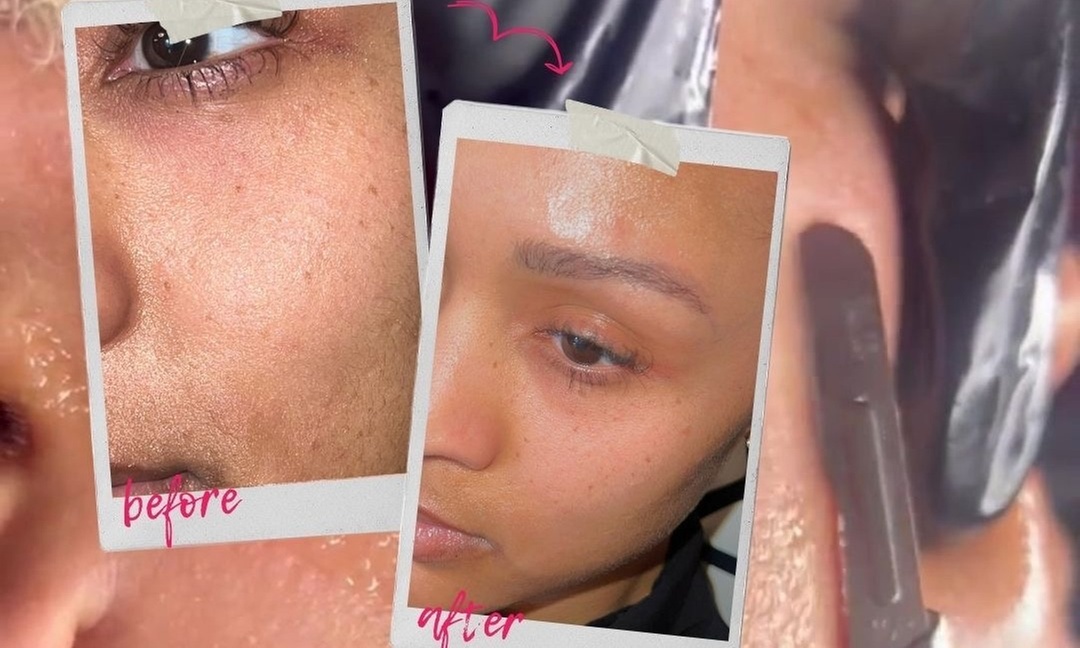 Rejuvenate with Black Bella Dc Body Sculpting's Anti-Aging and ProCell Facial Treatments, up to 45% off