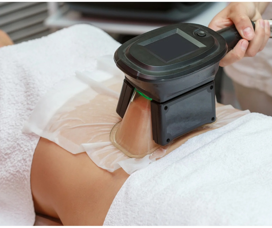 Technologie die je leven makkelijker maakt: cryolipolyse behandeling