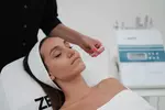 Up to 60% Off on Micro-Needling at Skinneon Beauty