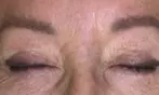 Achieve Ink-Free Skin with Laser by Nicole's Tattoo Removal for All Sizes up to 39%