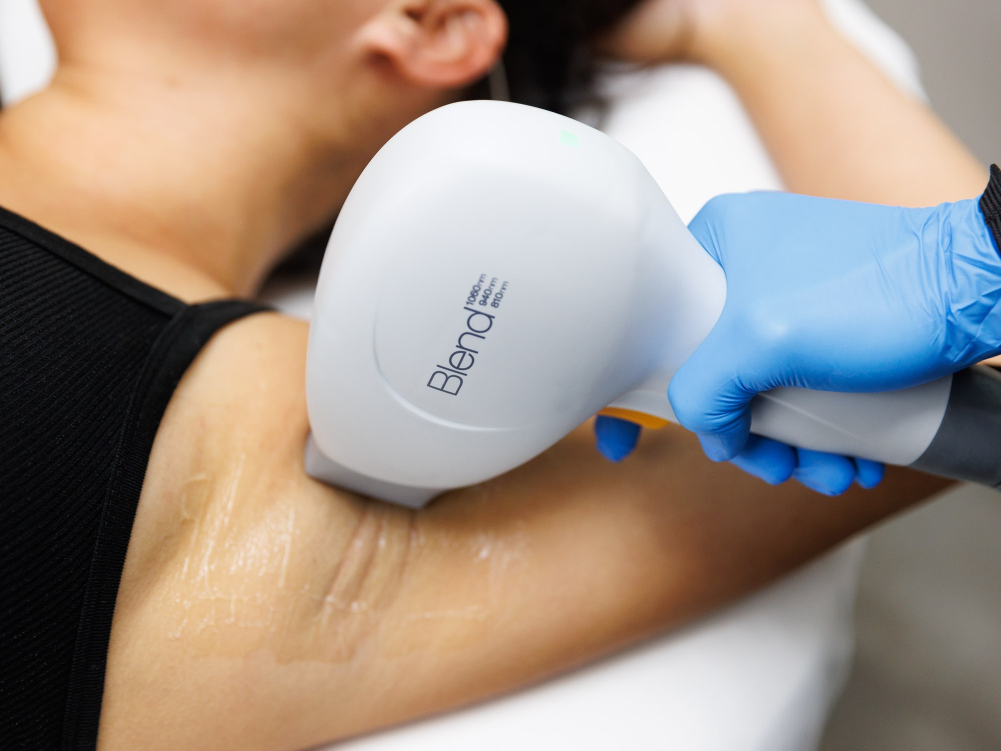 Enjoy 6 Sessions of Laser Hair Removal for Various Areas