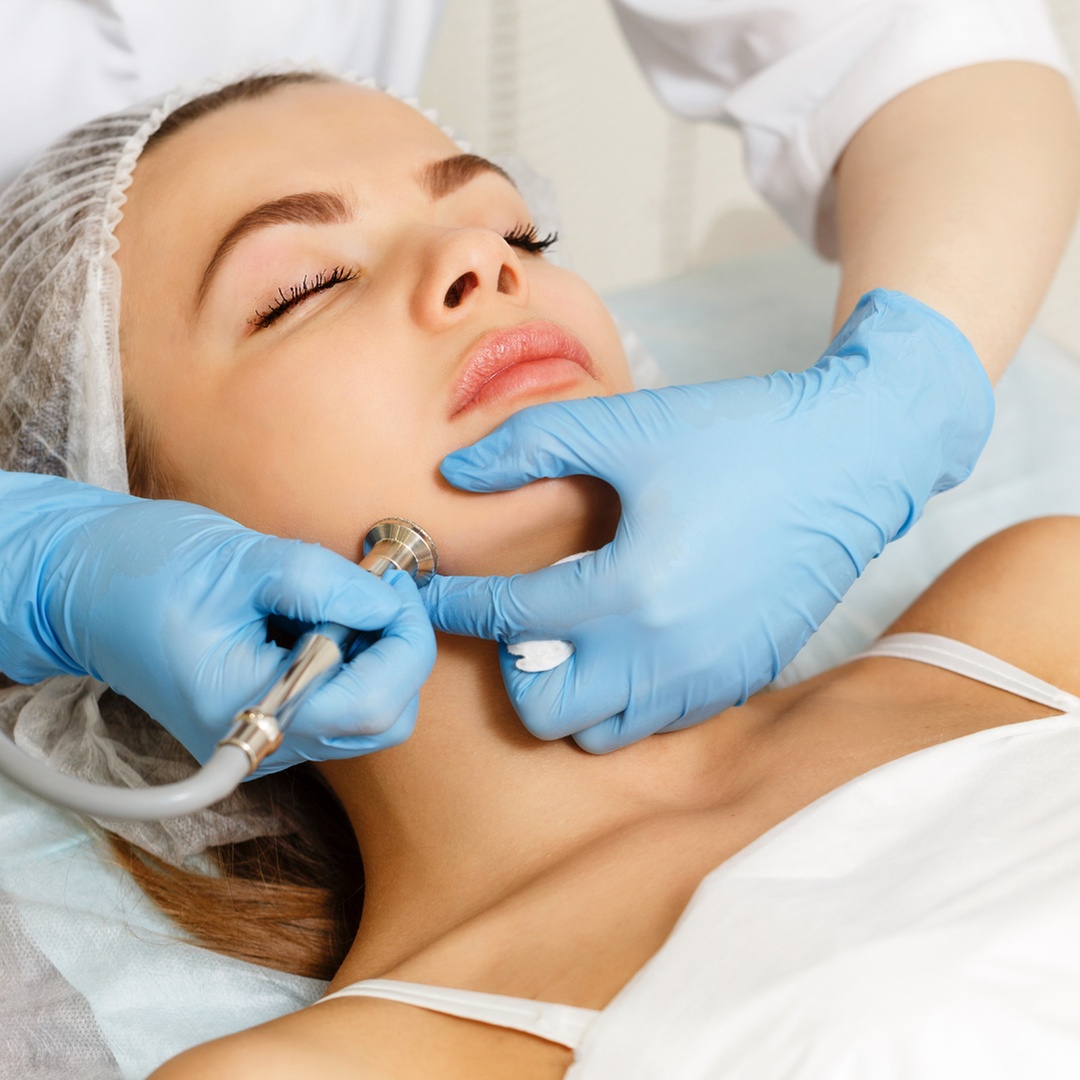 Experience Rejuvenating Microdermabrasion for Radiant Skin