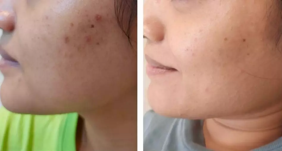 Experience a Revitalizing VI Peel or Diamond Glow Facial at Enigma Medi Spa & Laser Center (Up to 44% Off)