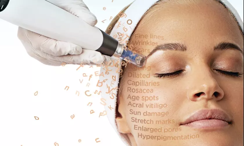 Up to 50% Off on Micro-Needling at PBS Spa