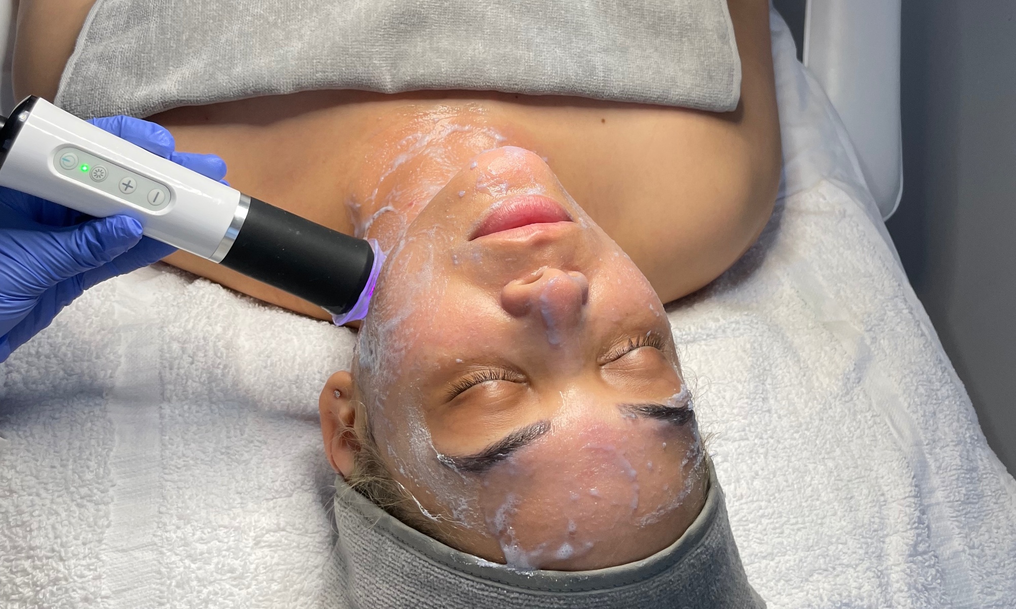 Discover Revive Esthetic's Facial Options w/ Tailored Skin Treatments