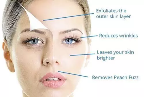 Revitalize Your Skin with Dermaplaning and LED Treatment