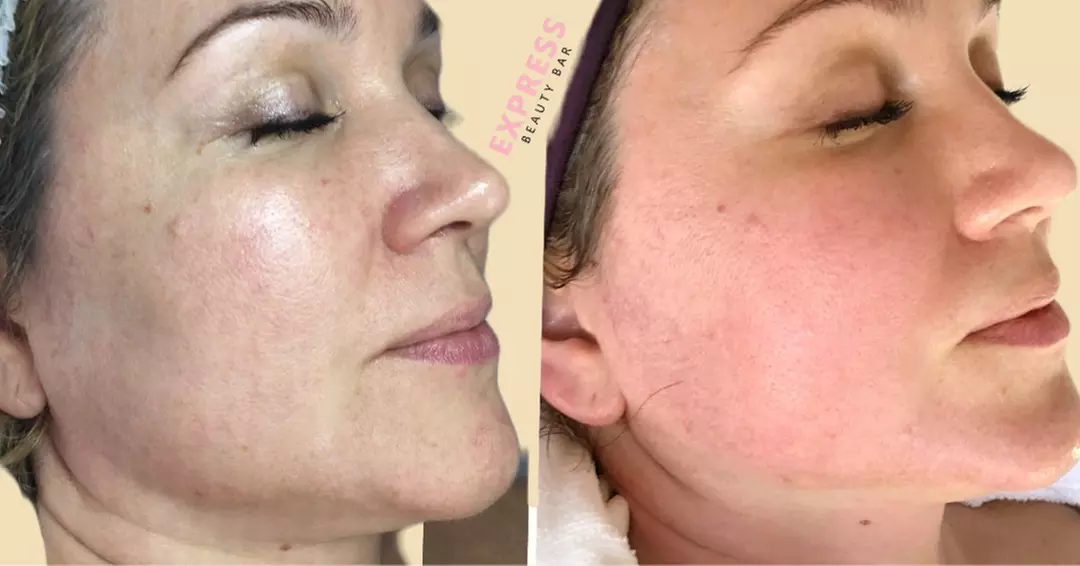 Up to 55% Off on Facial at Express Beauty Bar