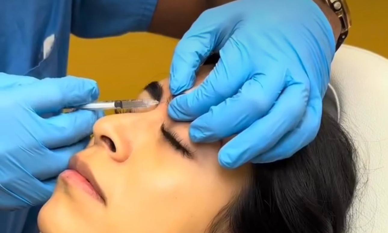 Revitalize Your Look with 30 or 40 Units of Botox or Xeomin