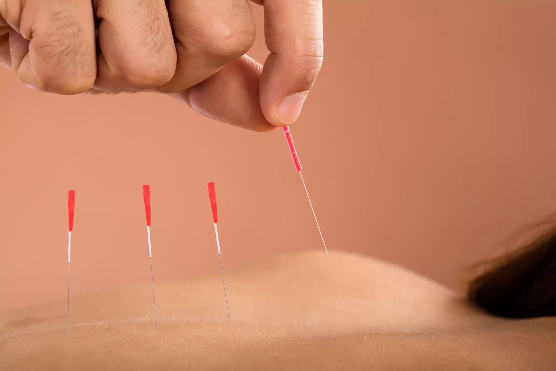 Health Review + Acupuncture & Cupping or Gua Sha treatment with Doctor of Acupuncture at Dao Integrated Health (Up to 61% Off) - Primary Image
