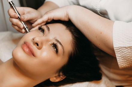One Session:  Dermapen microneedling - London Ladies Hair And Beauty Clinic
