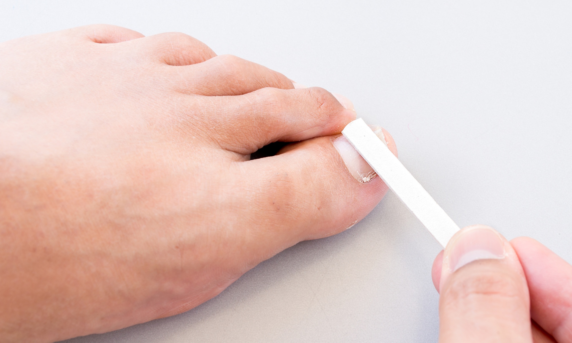 Up to 74% Off on Toe Fungus Treatment at Cosmetology Clinic