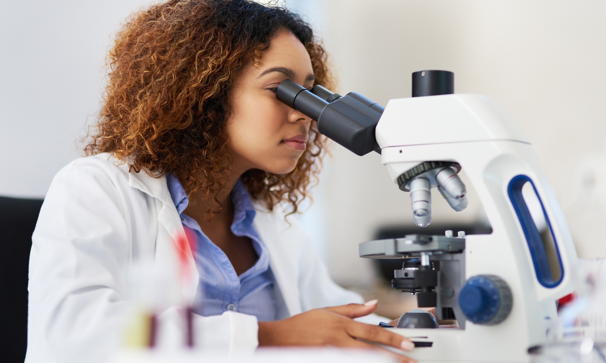 Comprehensive Allergy Test – 150 Items, Hair Test Only, Test from DNA