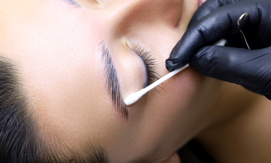 Image 1: Radiant Skin with Fractional Radio Frequency Microneedling