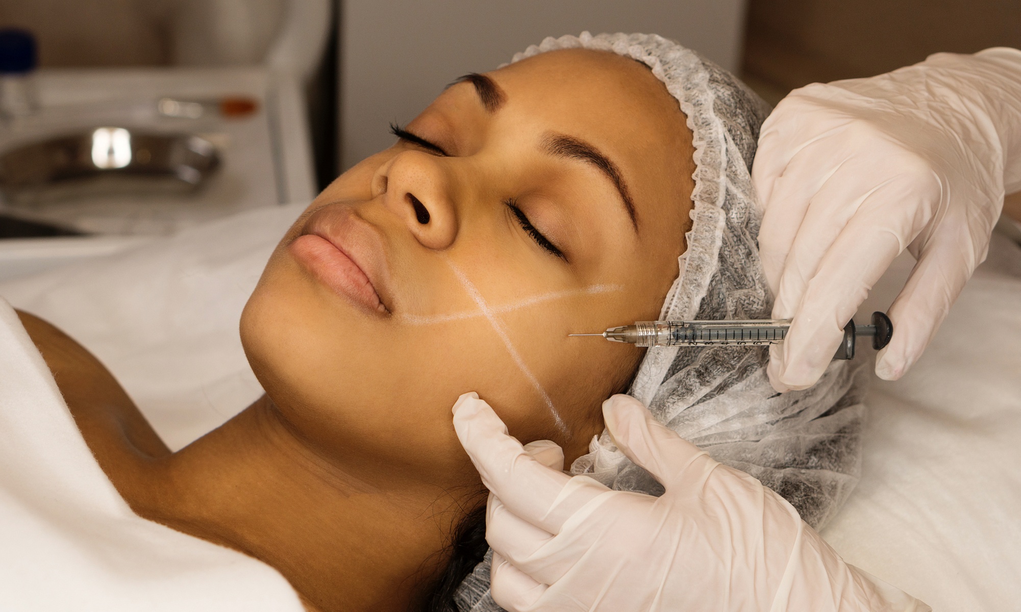 Up to 30% Off on Injection - Dermal Filler at Gentle Giant Care