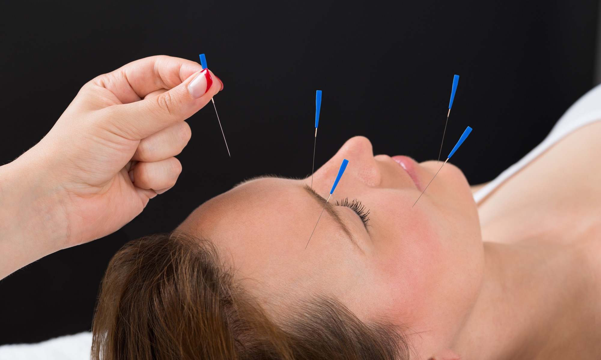 Acupunctuur in Amersfoort