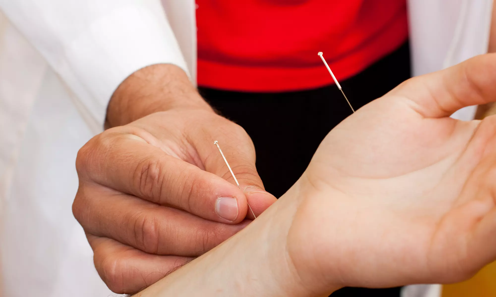 One, Three or Six Acupuncture Treatments with Consultation