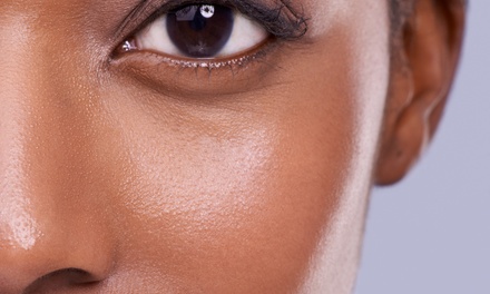 Three 30-Minute Dermaplaning Treatments - Rekyndle Youth