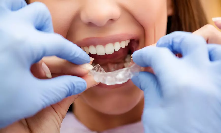 Image 1: Paga 39,99 € y obtén un descuento de 2000 € en ortodoncia Invisalign