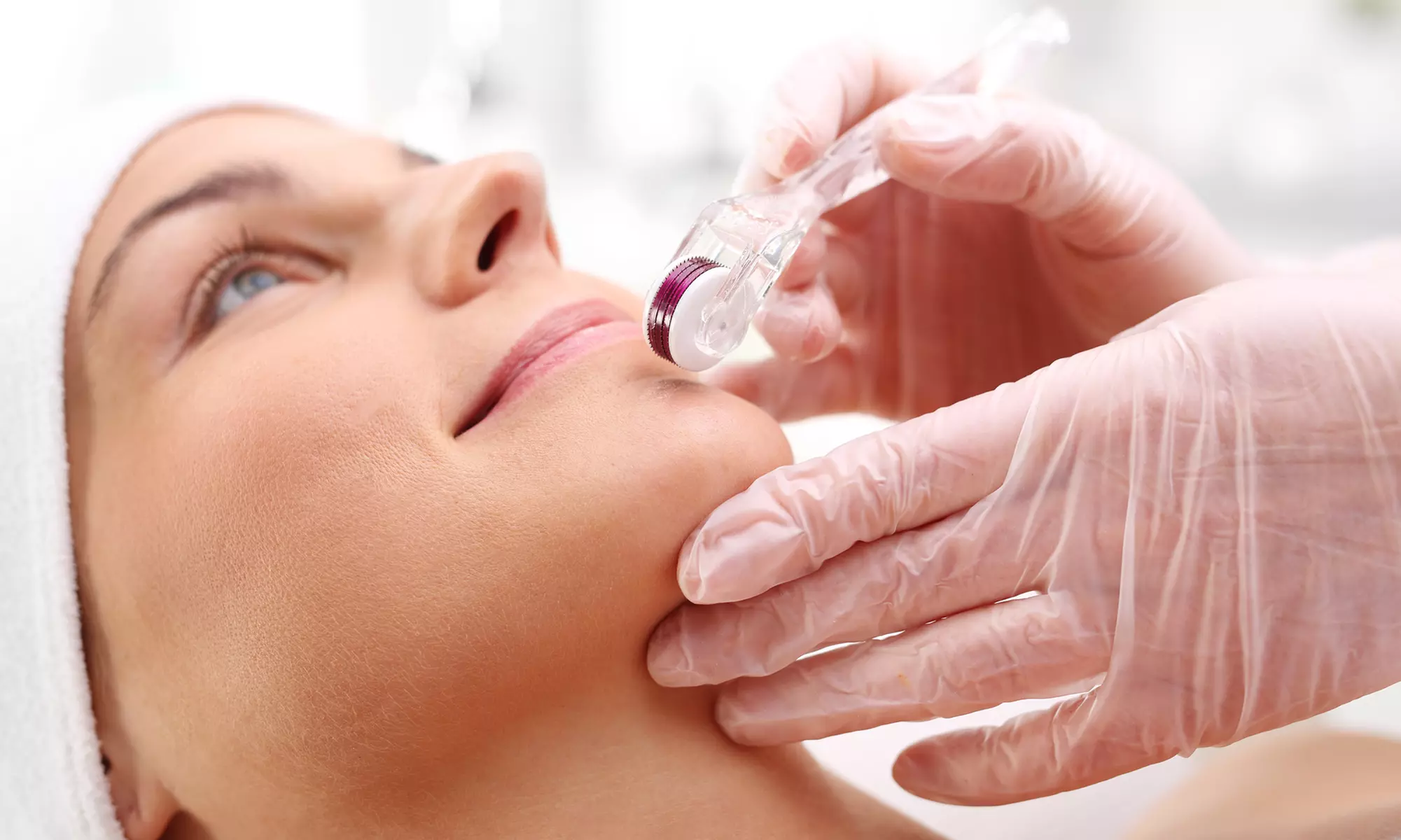 One Microneedling Treatment at Infinity Med Spa (Up to 40% Off). Two Options Available.  - Primary Image