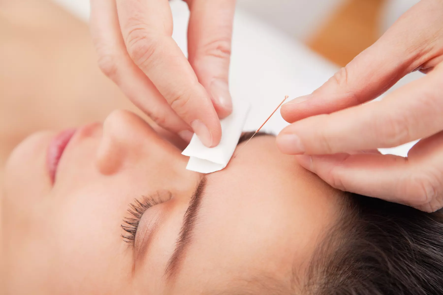 Experience relief at Acupuncture and Beauty Spa with acupuncture sessions for stress, anxiety or digestion up to 50% - Primary Image