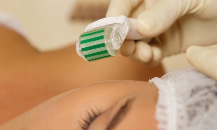 One session of skin needling or glow skin treatment - Reem Beauty Factory
