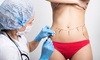 Chin Liposuction, Liposuction for Two Areas , or Plastic Surgery Consultation + $1.000 Credit (Up to80% Off)