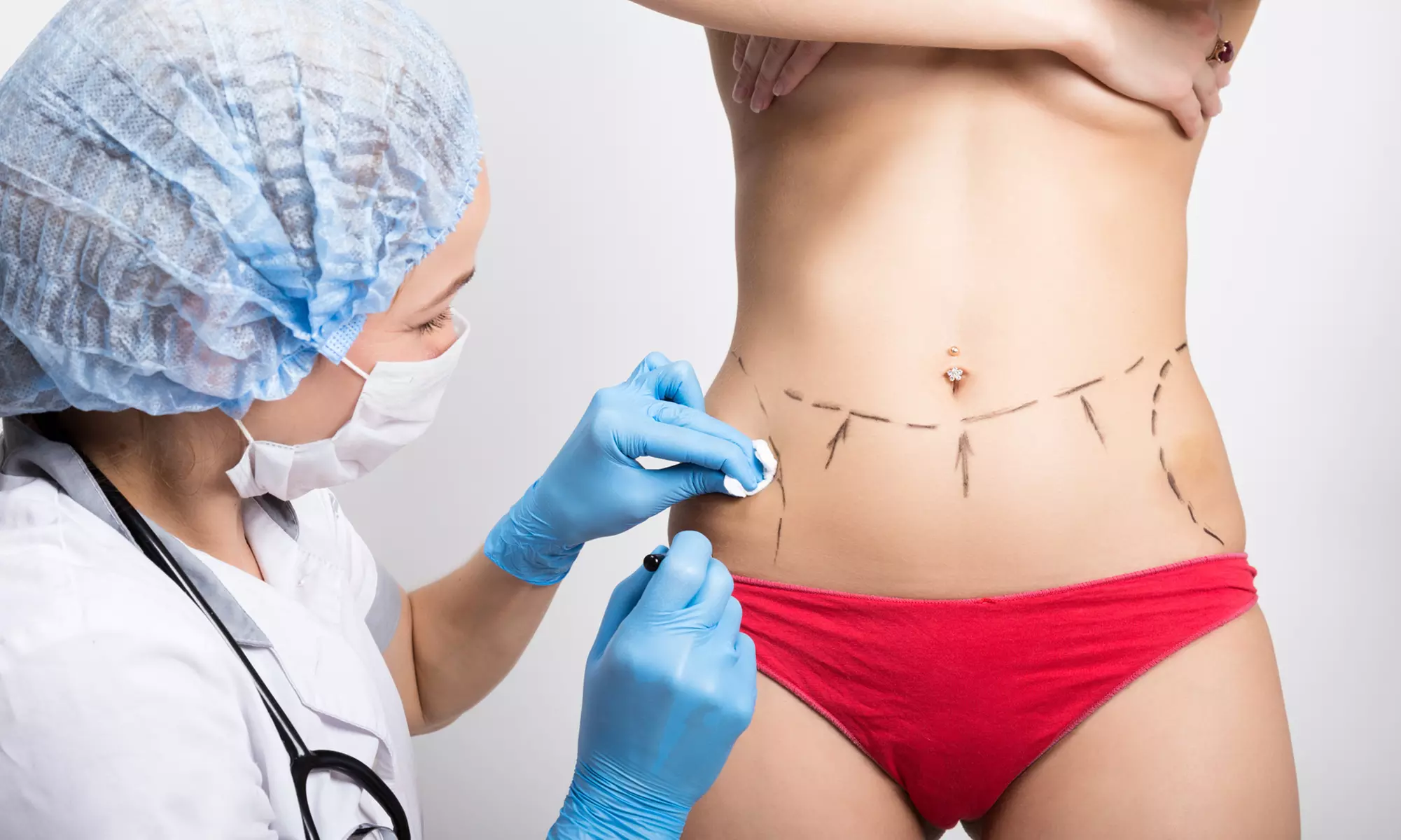 Chin Liposuction, Liposuction for Two Areas , or Plastic Surgery Consultation + $1.000 Credit (Up to80% Off) - Primary Image