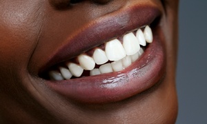 One-Hour Teeth Whitening Session