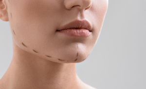 Reduce double chin with deoxycholic acid injections