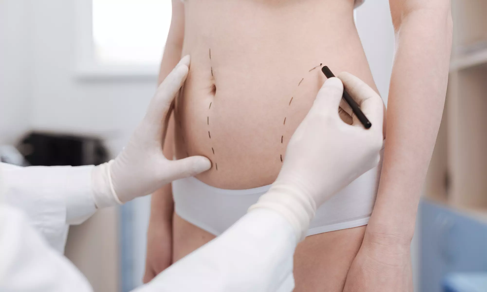 Experience One, Two, or Three Non-Surgical Laser Lipo Sessions Up to 70% Off at Dr. Danish Verma: Beauty Max Spa - Primary Image
