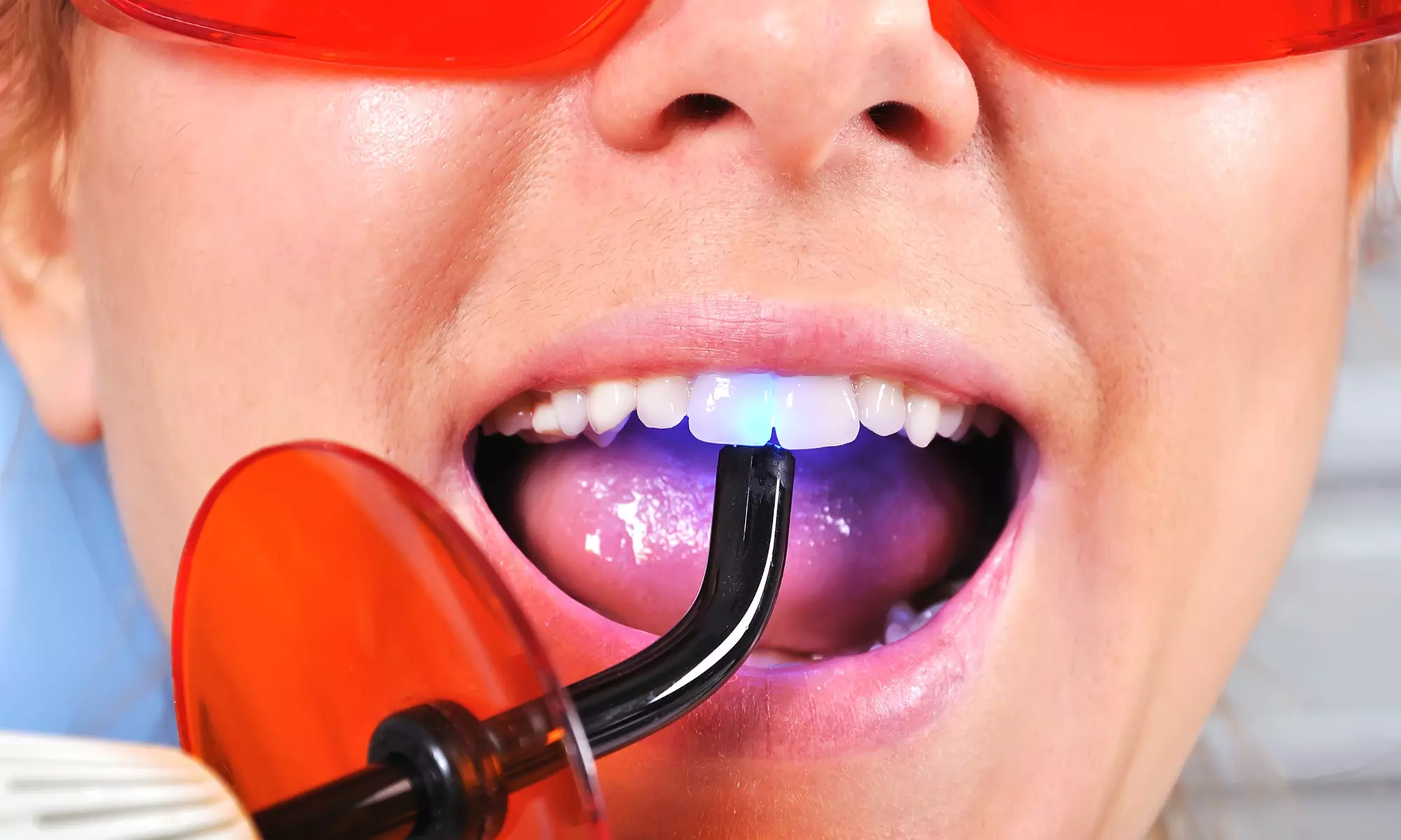 In-Office Advanced Teeth-Whitening Session or Teeth Gem Session at Maliyah Minks Lashes and Brows - Primary Image