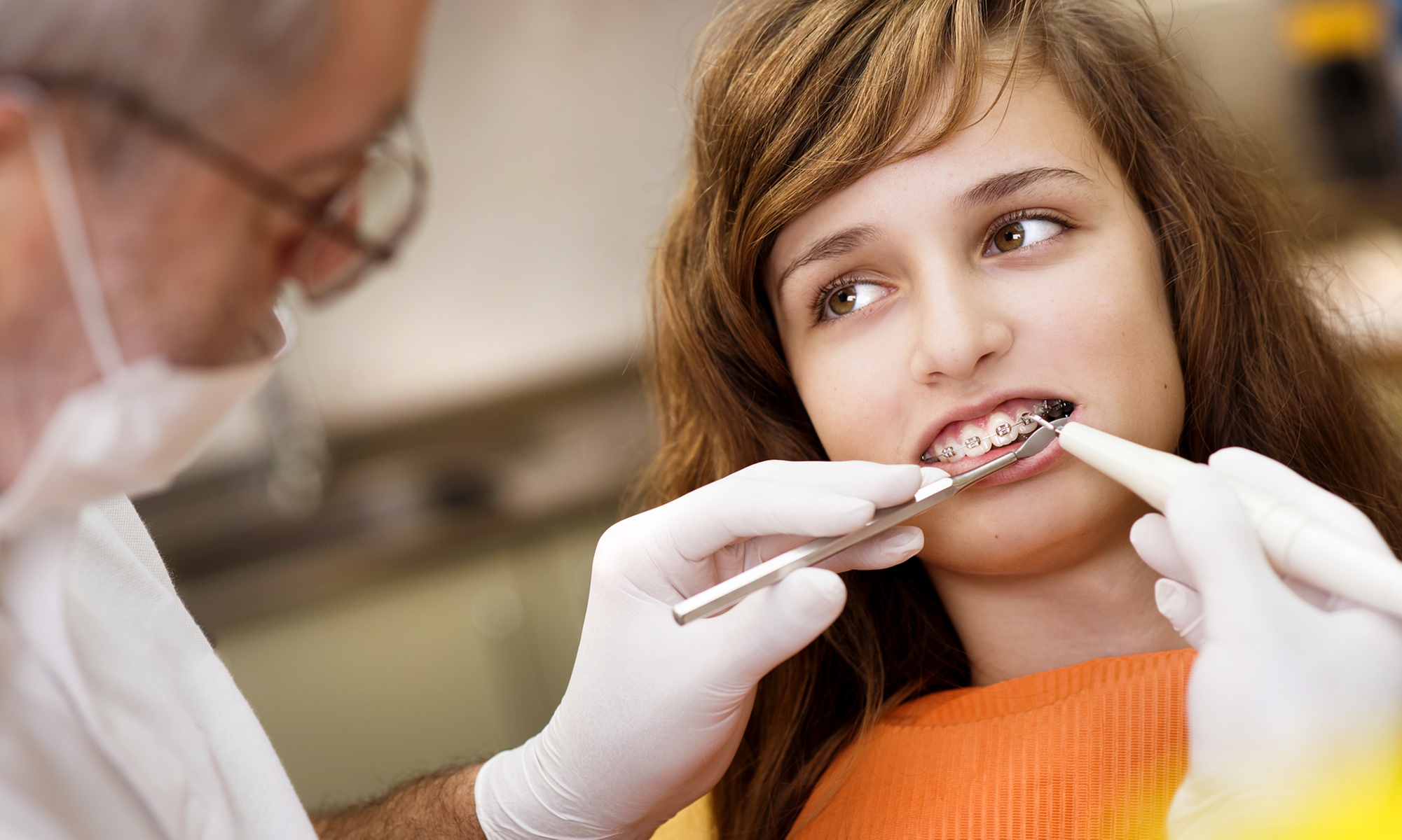 Stunning Smile with Clear Aligners, Clear/Metal Braces