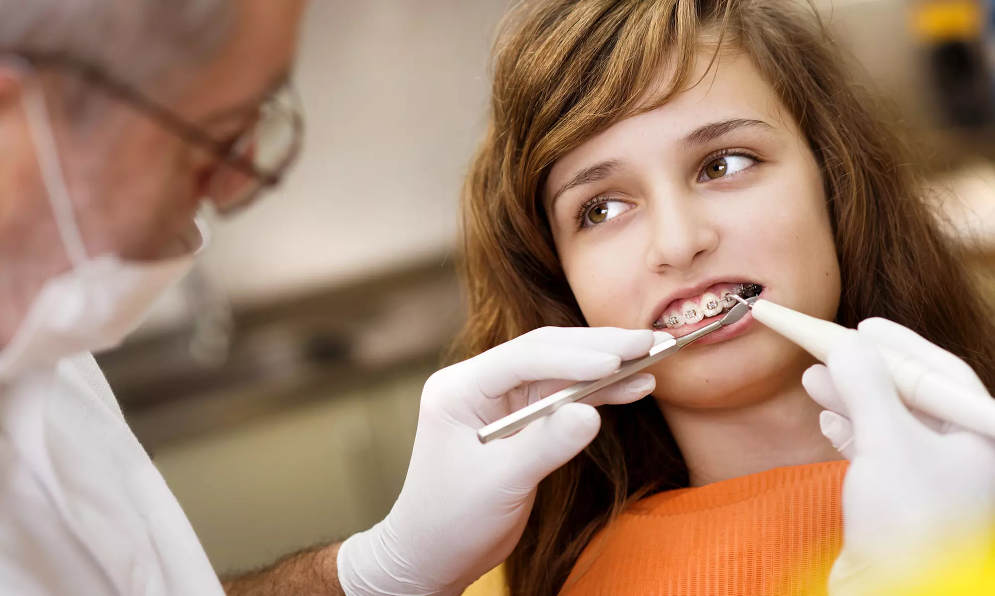 Stunning Smile with Clear Aligners, Clear/Metal Braces