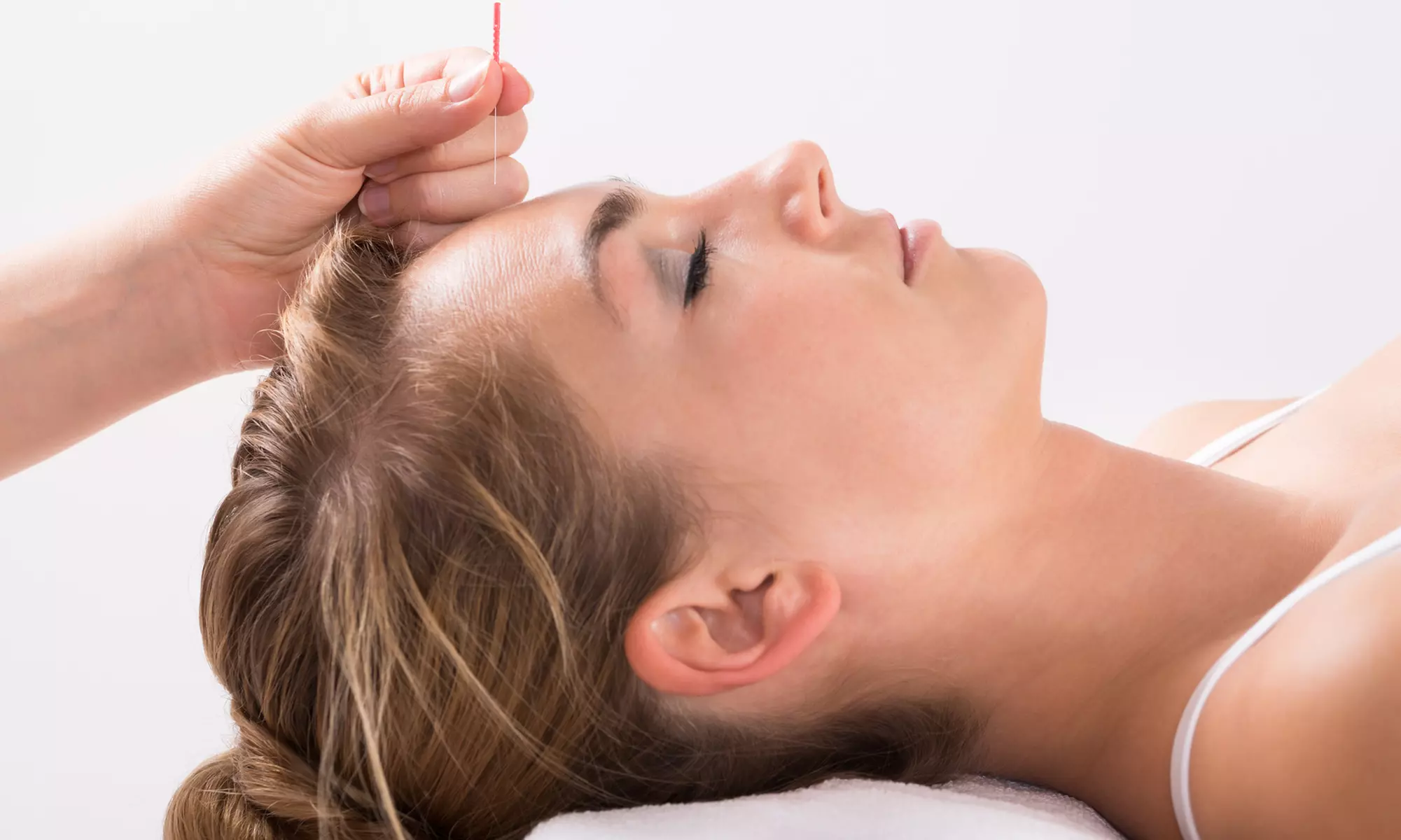 One or Three Acupuncture Treatment with Tuina and Hot Stone at Lakeside Acupuncture and Massage (Up to 46% Off) - Primary Image