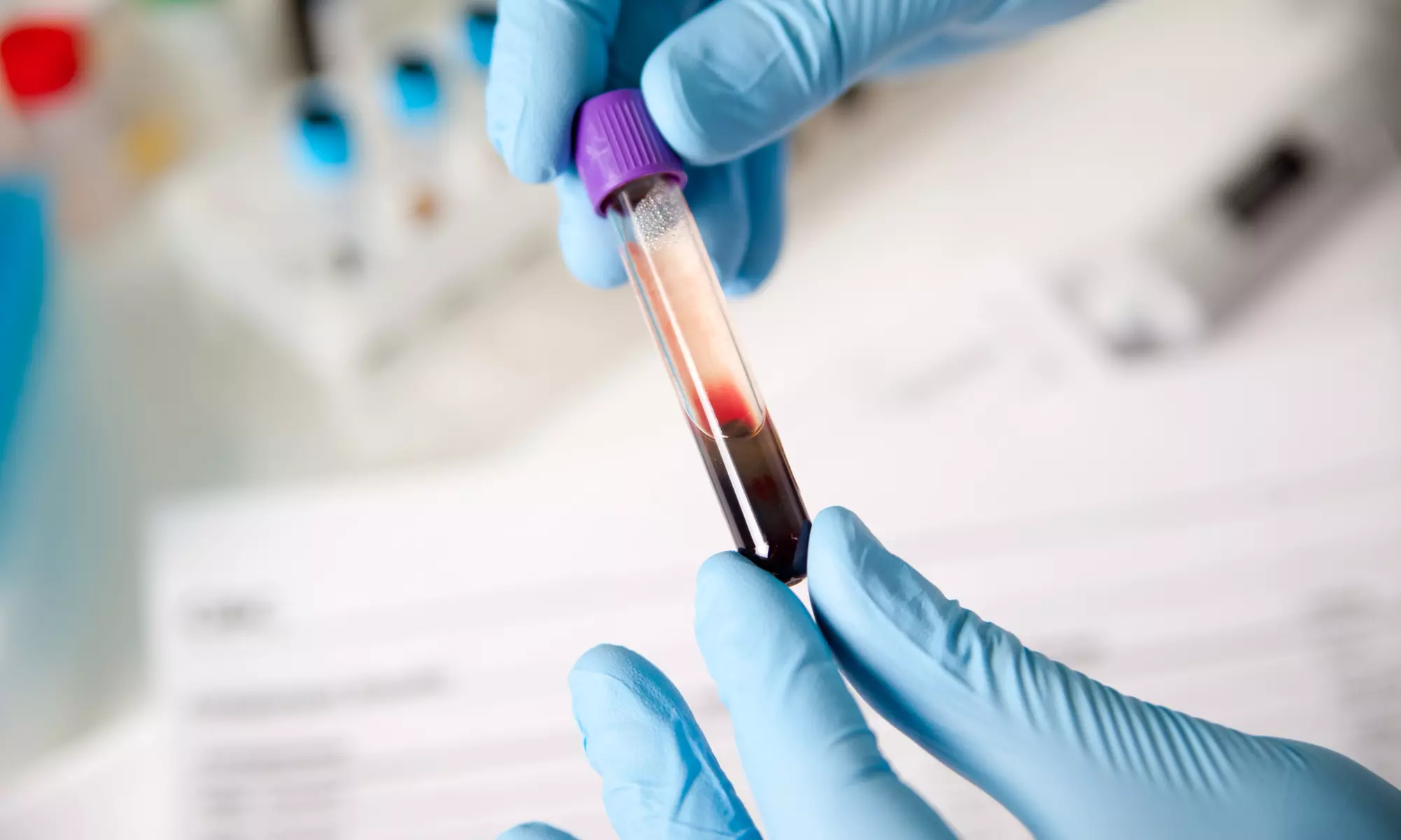 Up to 35% Off on Phlebologist at Phlebotomy Training Institute - Primary Image
