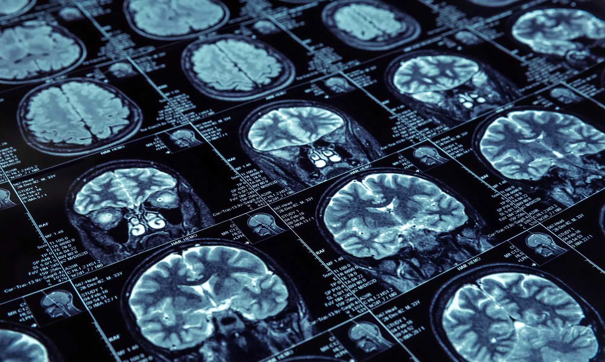 Rezonans magnetyczny 1 wybranego stawu, głowy lub całego kręgosłupa w ArterieArt - Primary Image
