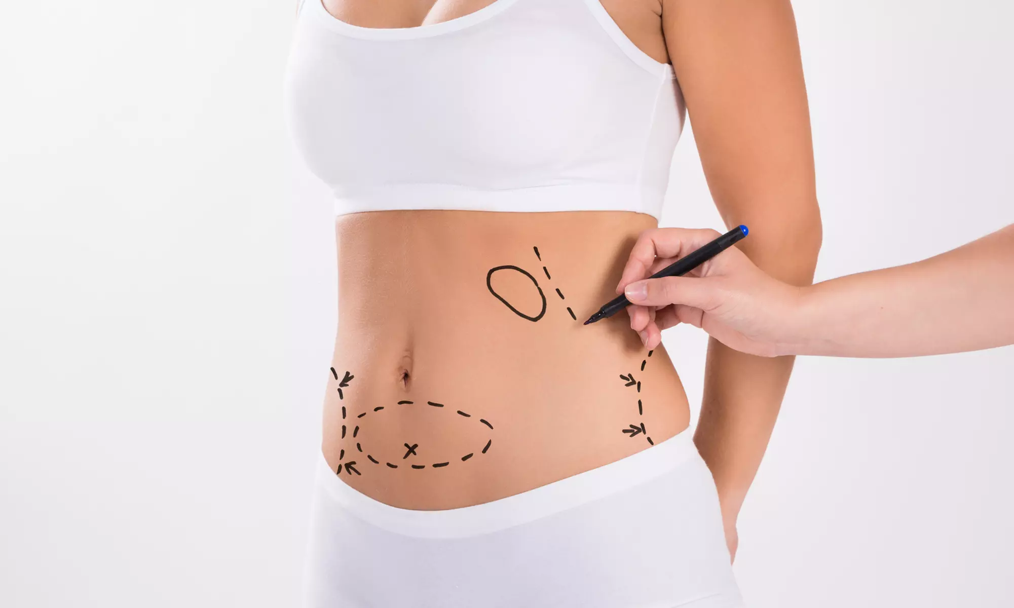 Do 50% zniżki na Redukcja tłuszczu/cellulitu - niemarkowe w SKINCARE Mokotów - Primary Image