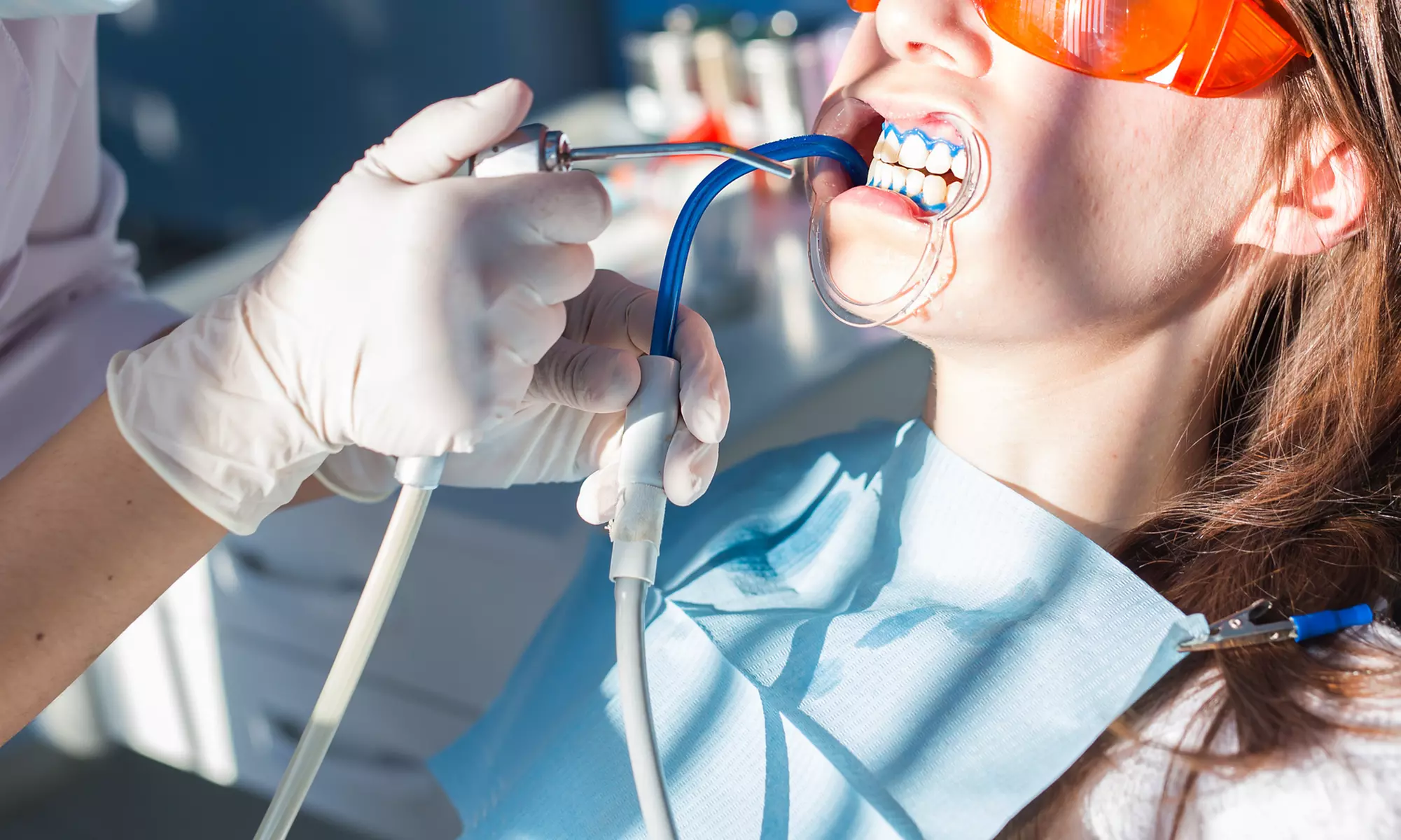 Achieve a Brighter Smile with a 60-Minute Teeth Whitening