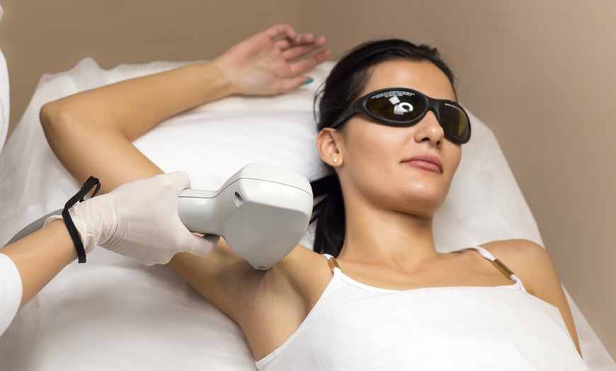 Image 1: Achieve Flawless Skin with Six Laser Hair-Removal Sessions