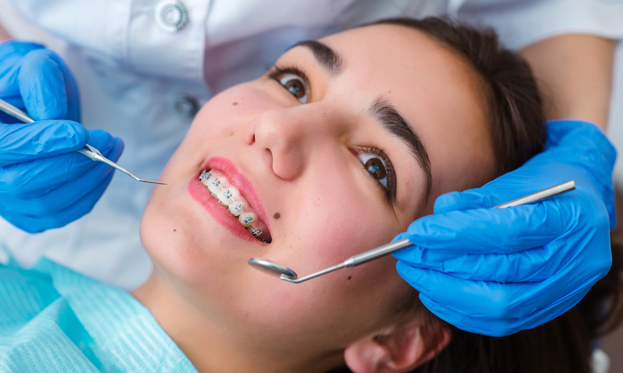 Up to 45% Off on Dental Checkup (Cleaning, X-Ray, Exam) at Glengowrie Dental