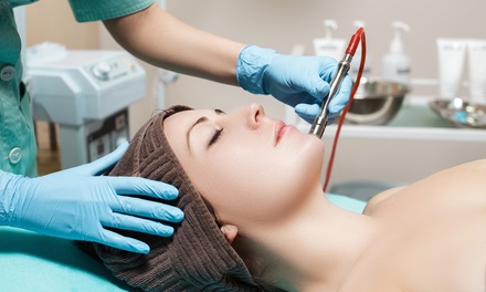 60-minute Microneedling with initial Skin Consultation x 1 Session - Skinhaven Aesthetics