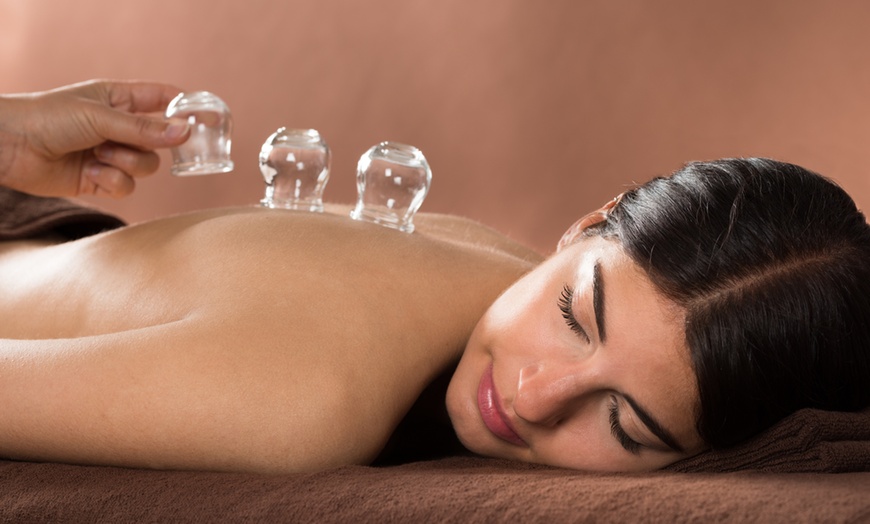 Image 1: Dry Needling, Cupping and Massage