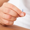 Image 2: Acupuncture, Massage & Facial for Pain Relief & Balance