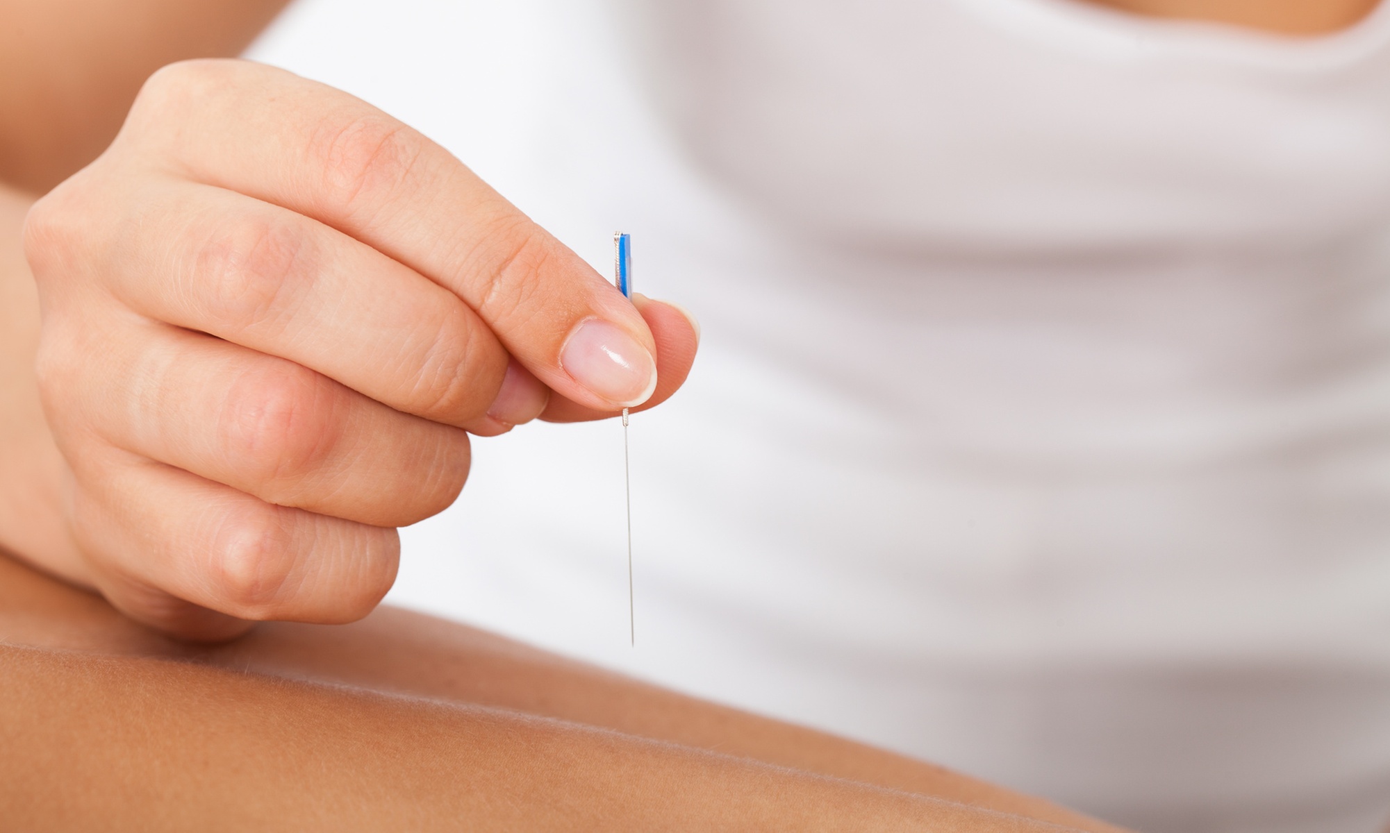 Achieve Balance: Acupuncture Session with Optional 30-Minute Massage